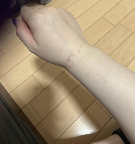 傷ついてなんぼ…画像１