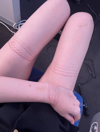 20時〜います！　愛しき縄跡🪢画像１