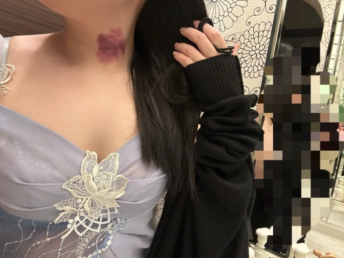 少し早いですが、画像２